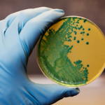 Compass on Listeriosis Crisis